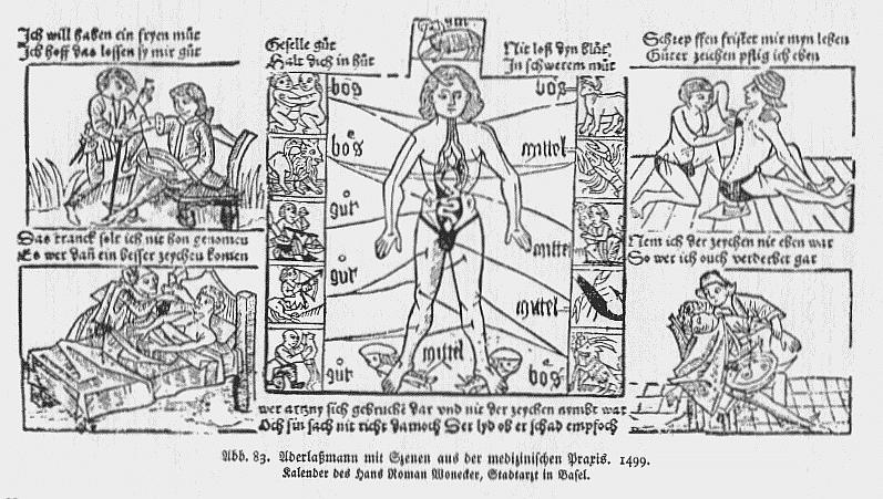 mittelalterliche Aderlass Darstellung